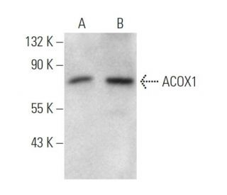 ACOX1 Antibody (153CT43.1.1) - Western Blotting - Image 374575SAM Transcription Activation: SAM system utilizing dCas9-VP64, MS2-P65-HSF1, and sgRNA for precise gene transcription activation. 