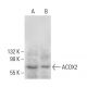 ACOX2 Antibody (A-7) - Western Blotting - Image 385276