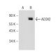 ACOX2 Antibody (D-10) - Western Blotting - Image 149207