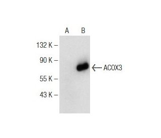 ACOX3 Antibody (G-9) - Western Blotting - Image 147355