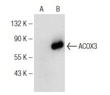 Acox3 ACOX3抗体 (G-9) | SCBT - Santa Cruz Biotechnology