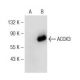 ACOX3 Antibody (G-9) - Western Blotting - Image 147355