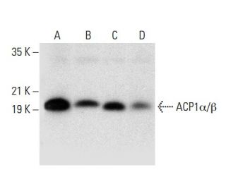 ACP1&alpha;/&beta; Antibody (B-2) - Western Blotting - Image 304505