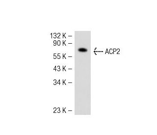 ACP2 Antibody (4B5) - Western Blotting - Image 51202 