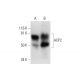 ACP2 Antibody (B-7) - Western Blotting - Image 289018