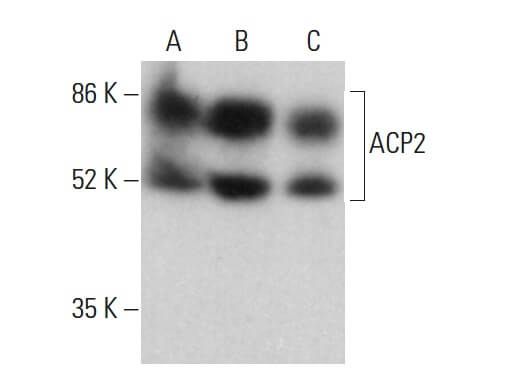 ACP2 Antibody (B-7) | SCBT - Santa Cruz Biotechnology