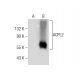 ACPL2 Antibody (H-4) - Western Blotting - Image 283440