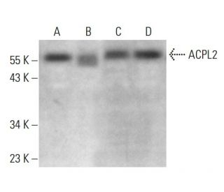 ACPL2 Antibody (H-4) - Western Blotting - Image 376247 