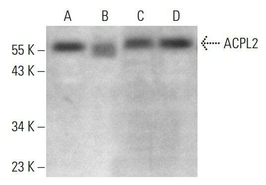 ACPL2 Antibody (H-4) | SCBT - Santa Cruz Biotechnology
