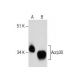 western blotting image from recommended Acrp30 (31) monoclonal antibody replacement. Image 281412