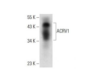 ACRV1 Antibody (A-9) - Western Blotting - Image 305732