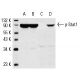 Western Blotting Luminol Reagent: sc-2048. Western blot analysis of Stat1 phosphorylation in untreated (A,C) and IFN-&amp;gamm