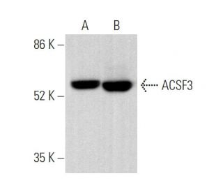 ACSF3 Antibody (F-5) - Western Blotting - Image 375056 