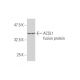 ACSL1 Antibody (3G4) - Western Blotting - Image 348480