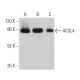western blotting image from recommended ACSL4 (F-4) monoclonal antibody replacement. Image 359692