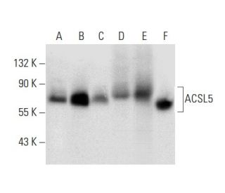 ACSL5 Antibody (E-12) - Western Blotting - Image 303757 