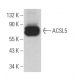 ACSL5 Antibody (E-12) - Western Blotting - Image 366077