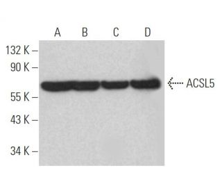 ACSL5 Antibody (A-2) - Western Blotting - Image 366076Each CRISPR/Cas9 Knockout (KO) Plasmid product consists of a pool of 3 plasmids designed to ensure identification and cleavage of a specific gene for maximum knockout efficiency. Each plasmid encodes a unique 20 nt sequence derived from the GeCKO (v2) library. 