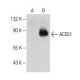 ACSS1 Antibody (A-10) - Western Blotting - Image 150598 