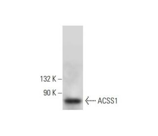 ACSS1 Antibody (D-7) - Western Blotting - Image 299019 