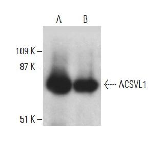 ACSVL1 Antibody (D-7) - Western Blotting - Image 397581The Double Nickase Plasmid features a U6 promoter for sgRNA expression, a 20 nt targeting sequence, and a gRNA scaffold to guide Cas9n. It includes a CBh promoter for Cas9n (D10A) and puromycin resistance, GFP for transfection verification, and nuclear localization signals (NLS). The 2A peptide allows co-expression of Cas9n and Puro from a single promoter, enabling precise genome editing with reduced off-target effects.
