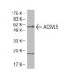 ACSVL4 Antibody (B-5) - Western Blotting - Image 34631 