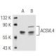ACSVL4 Antibody (B-5) - Western Blotting - Image 46750 