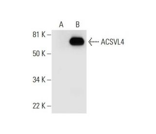 western blotting image from recommended ACSVL4 (H-6) monoclonal antibody replacement. Image 294549