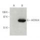 ACSVL4 Antibody (H-6) - Western Blotting - Image 397529
