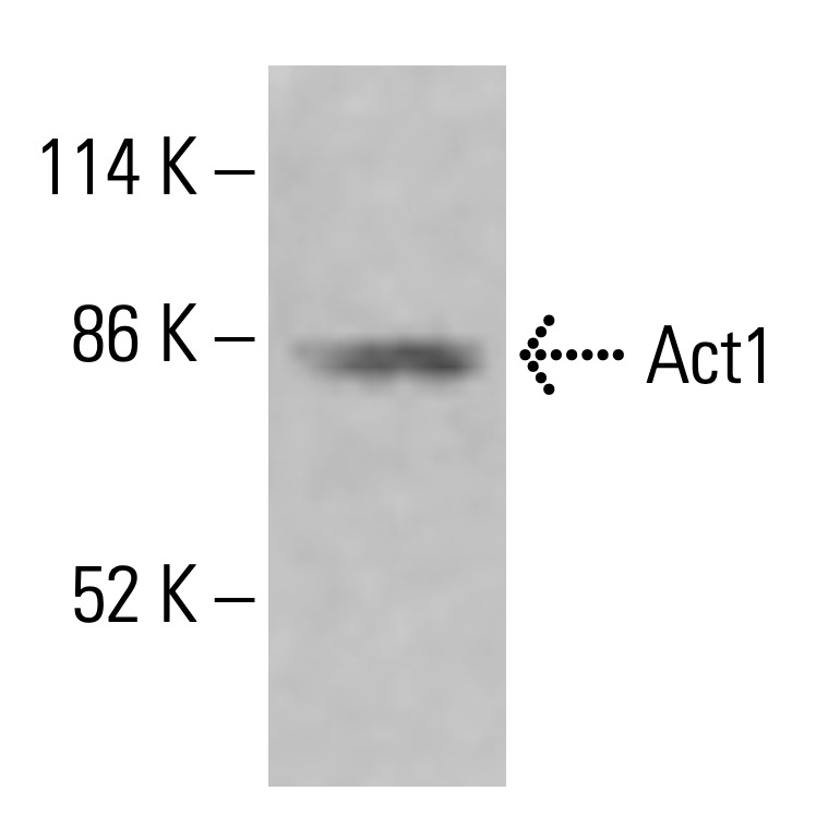 Act1 Antibody (D-11) | SCBT - Santa Cruz Biotechnology