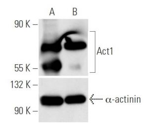 Act1 siRNA (h): sc-29634. Western blot analysis of Act1 expression in non-transfected control (A) and Act1 siRNA transfect 