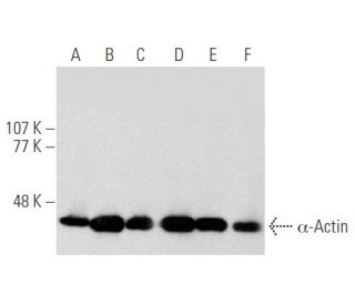 α-Actin Antibody (1A4) - Western Blotting - Image 356532