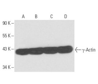 γ-Actin Antibody (1-17) - Western Blotting - Image 16455