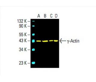 &gamma;-Actin Antibody (1-17) - Western Blotting - Image 394256 