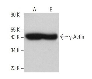 γ-Actin Antibody (1-17) - Western Blotting - Image 374826