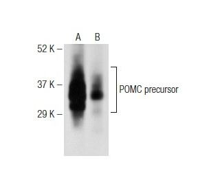ACTH Antibody (2F6) - Western Blotting - Image 146434 