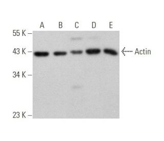 Actin Antibody C 2 SCBT Santa Cruz Biotechnology