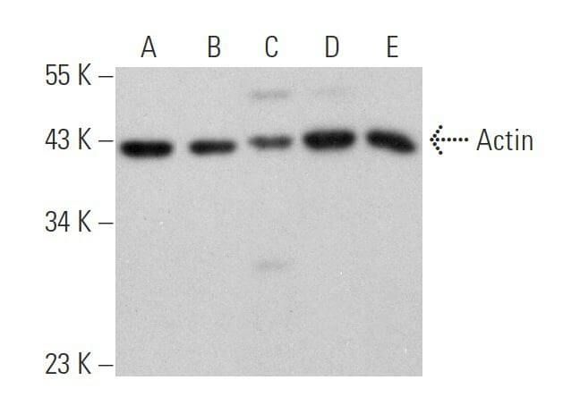 Actin Antibody C 2 SCBT Santa Cruz Biotechnology