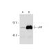 Actinomycin D: sc-200906. Western blot analysis of p53 expression in...
