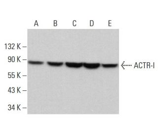 ACTR-I Antibody (C-5) - Western Blotting - Image 381962Each CRISPR/Cas9 Knockout (KO) Plasmid product consists of a pool of 3 plasmids designed to ensure identification and cleavage of a specific gene for maximum knockout efficiency. Each plasmid encodes a unique 20 nt sequence derived from the GeCKO (v2) library. 