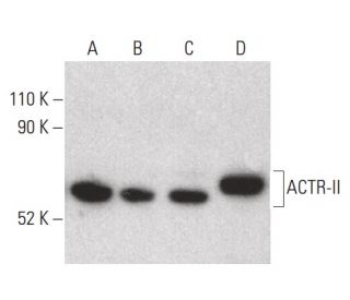 western blotting image from recommended ACTR-II (F-12) monoclonal antibody replacement. Image 399651