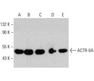 ACTR-IIA Antibody (D-9) - Western Blotting - Image 388017Each CRISPR/Cas9 Knockout (KO) Plasmid product consists of a pool of 3 plasmids designed to ensure identification and cleavage of a specific gene for maximum knockout efficiency. Each plasmid encodes a unique 20 nt sequence derived from the GeCKO (v2) library. 