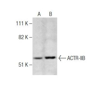 ACTR-IIB Antibody (9D10) - Western Blotting - Image 283570