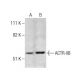 ACTR-IIB Antibody (9D10) - Western Blotting - Image 283570