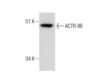 western blotting image from recommended ACTR-IIB (G-7) monoclonal antibody replacement. Image 283572
