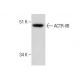 This polyclonal antibody has been discontinued. See our recommended <a href="actr-iib-antibody-g-7">ACTR-IIB (G-7)</a> monoclonal antibody (sample data shown). western blotting image from recommended ACTR-IIB (G-7) monoclonal antibody replacement. Image 283572