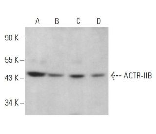 ACTR-IIB Antibody (G-7) - Western Blotting - Image 362830The Double Nickase Plasmid features a U6 promoter for sgRNA expression, a 20 nt targeting sequence, and a gRNA scaffold to guide Cas9n. It includes a CBh promoter for Cas9n (D10A) and puromycin resistance, GFP for transfection verification, and nuclear localization signals (NLS). The 2A peptide allows co-expression of Cas9n and Puro from a single promoter, enabling precise genome editing with reduced off-target effects.