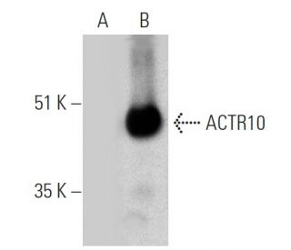ACTR10 Antibody (E-6) - Western Blotting - Image 364956 