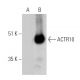 ACTR10 Antibody (E-6) - Western Blotting - Image 364956