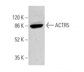 ACTR5 Antibody (E-8) - Western Blotting - Image 371660 